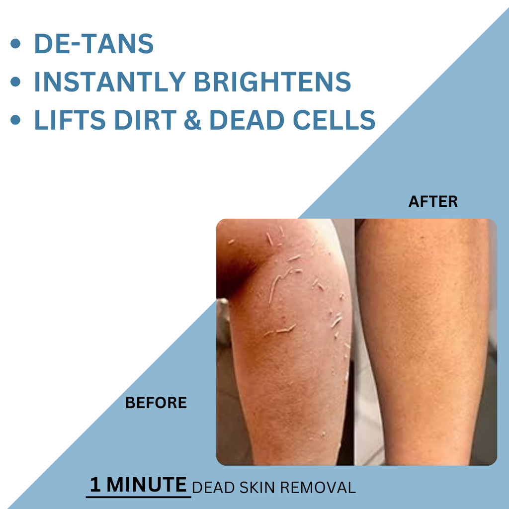 Dead Skin Removal exfoliating gel before & after 