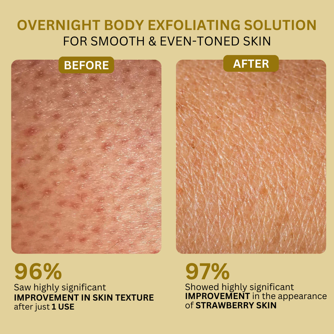 Overnight Glow Body Cream Before & After 
