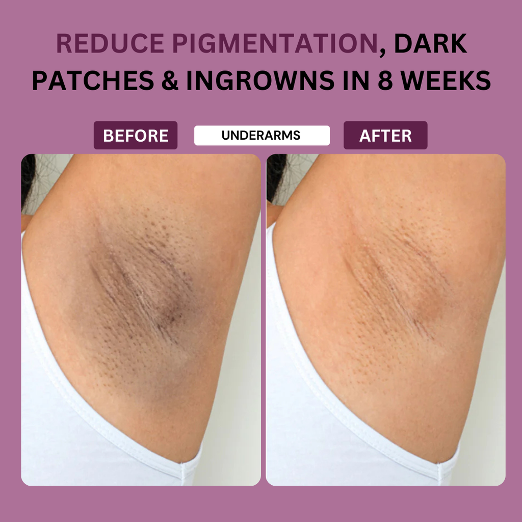 Sensitive area lightening Serum Before & After 
