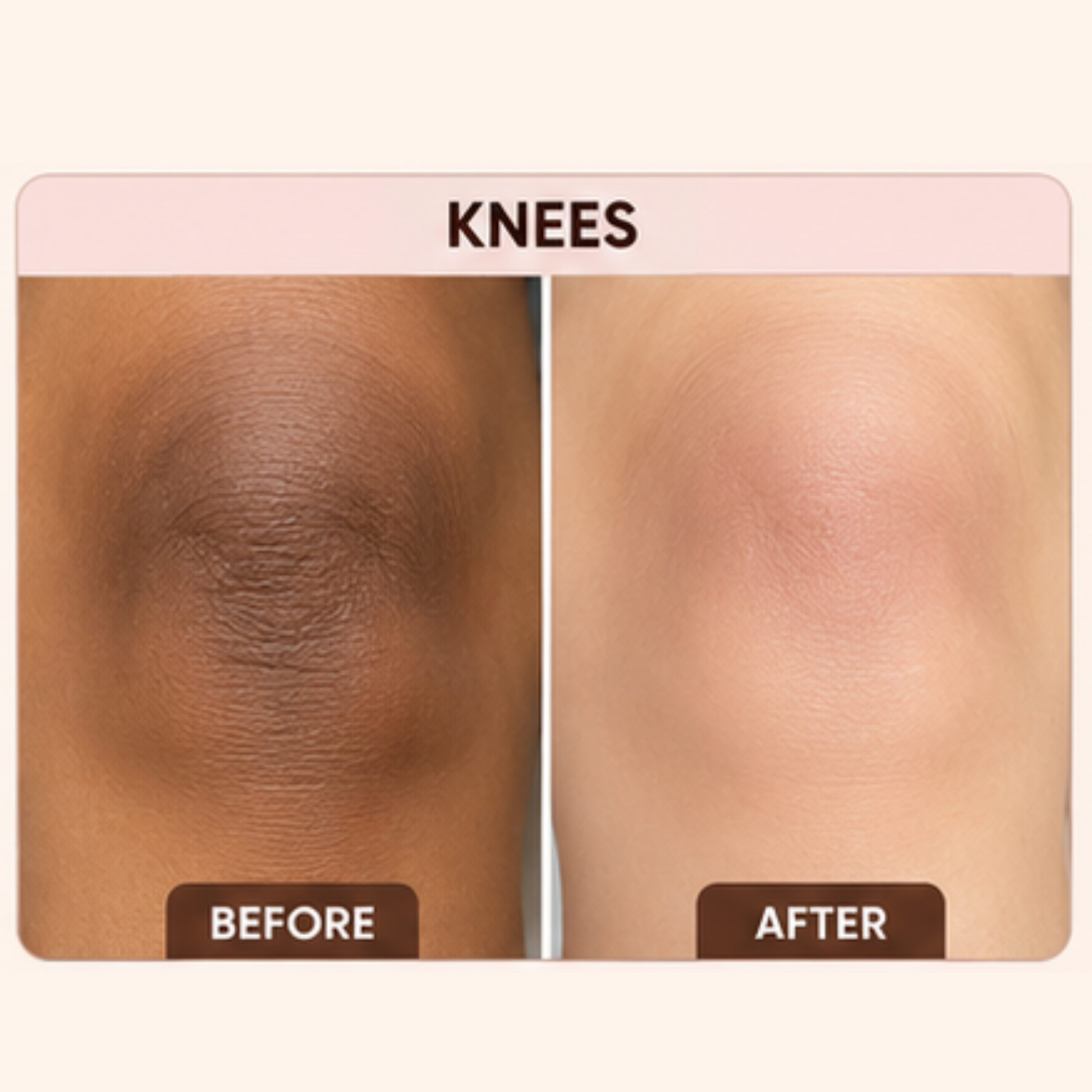 U16 Dead Skin Removal Exfoliating Gel with Cellulose, Lactic Acid & Scrub Beads