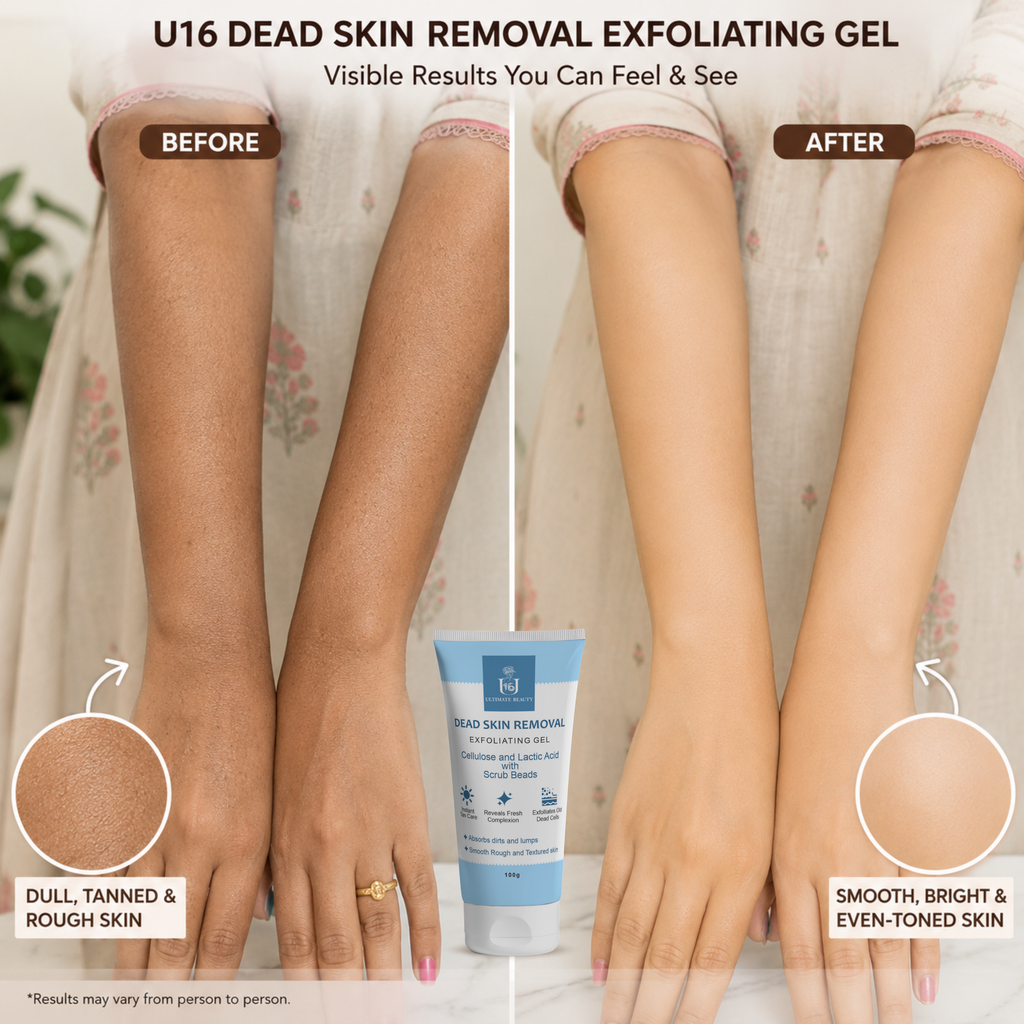Before and after comparison of dead skin removal exfoliating gel on hands with visible results.
