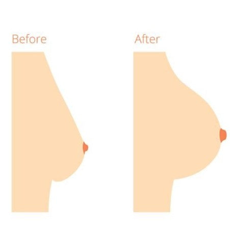 Safe & Natural Breast Massage Cream - 100ml