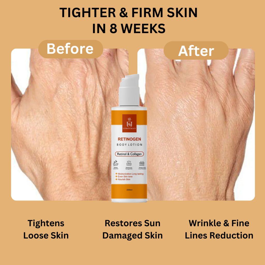 Retinogen Body Lotion Before & After Use 